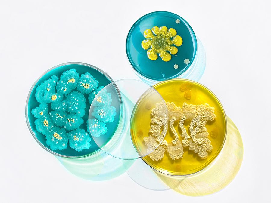 Three petri dishes containing colorful bacterial cultures on a white background. The dishes display intricate microbial patterns: one with teal and yellow flowers, another with yellow and white formations, and the third with blue and yellow structures.