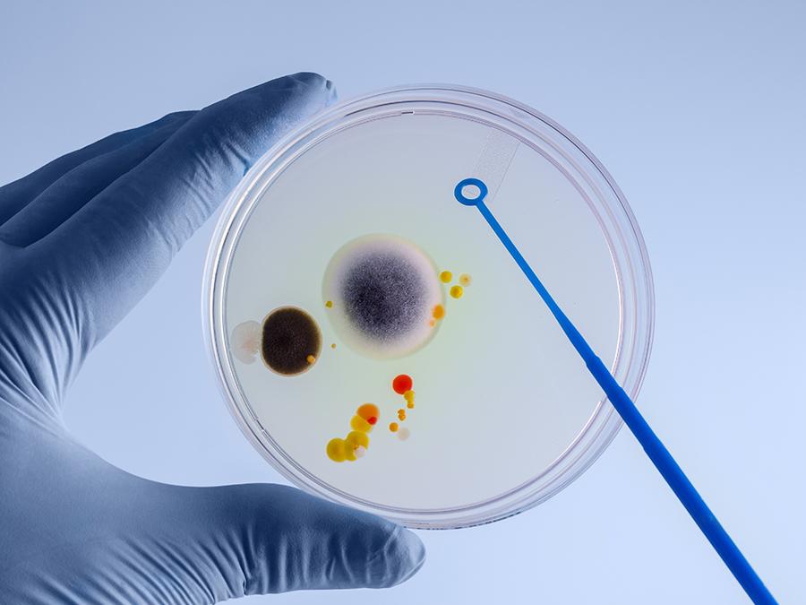 A gloved hand holds a petri dish containing various colorful bacterial colonies. A blue inoculating loop hovers above the dish, indicating the process of culturing or analyzing the bacteria. The background is a pale blue, creating a clinical laboratory setting.
