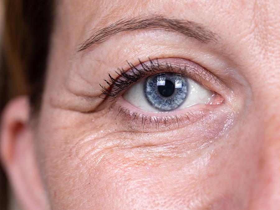 Close-up view of a person's eye with blue iris, framed by light eyebrow and short eyelashes. The skin surrounding the eye shows realistic texture and slight wrinkles, highlighting details of the person's face.