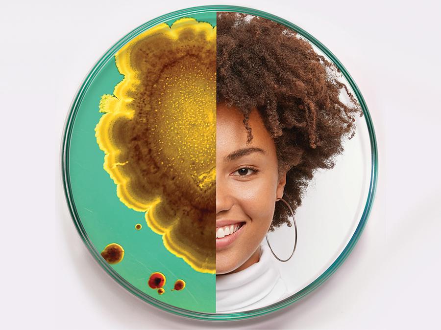 A round petri dish shows an image split in half. The left half contains a green medium with yellow and brown bacterial colonies, while the right half displays a smiling person with curly hair, wearing a white turtleneck and hoop earrings.